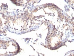 TGF-alpha Antibody (TGFA/1119), Novus Biologicals 0.2mg; Unlabeled:Antibodies,